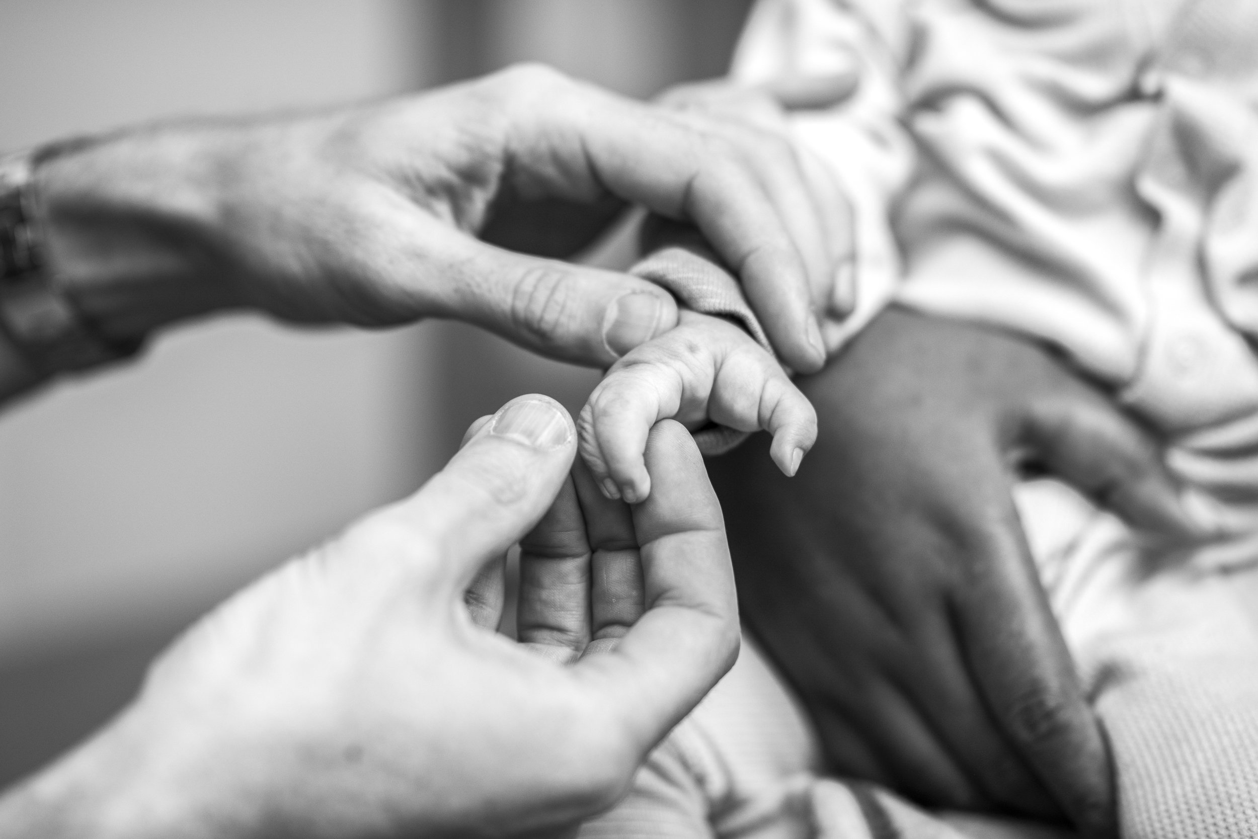  Tonga.  A 18 month year old with Syndactyly is examimed - a condition where hands and feet are webbed. On top of the malnutrition, clefted lip and palate this young man faces many challenges.  His treatment plan will take several operations, and man