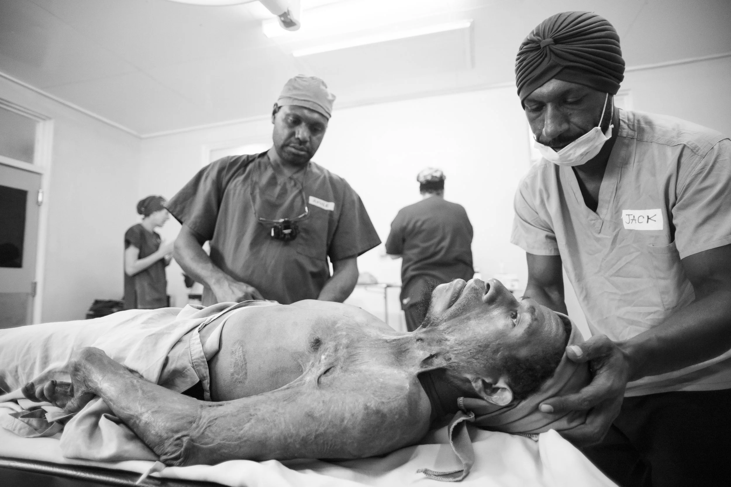 Vanimo, Papua New Guinea. Lemeck lays quietly on the operating table, awaiting Nkule the local Plastic Surgery trainee and Jack Justice ( real name! ) to begin anaesthesia. The full extent of his burns is visable, and upon touching his cold scar tissue I further understood his lack of mobilty as the skin felt like leather.