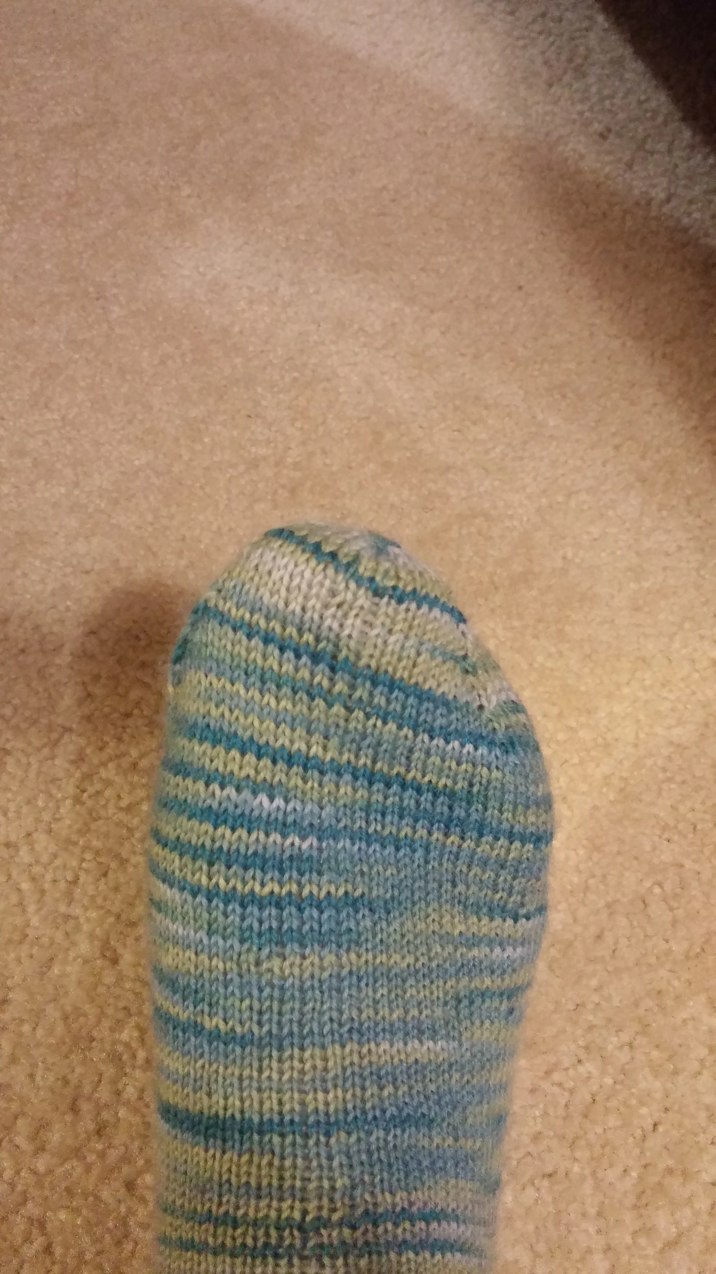 A pain-free beautifully completed Kitchener toe. 