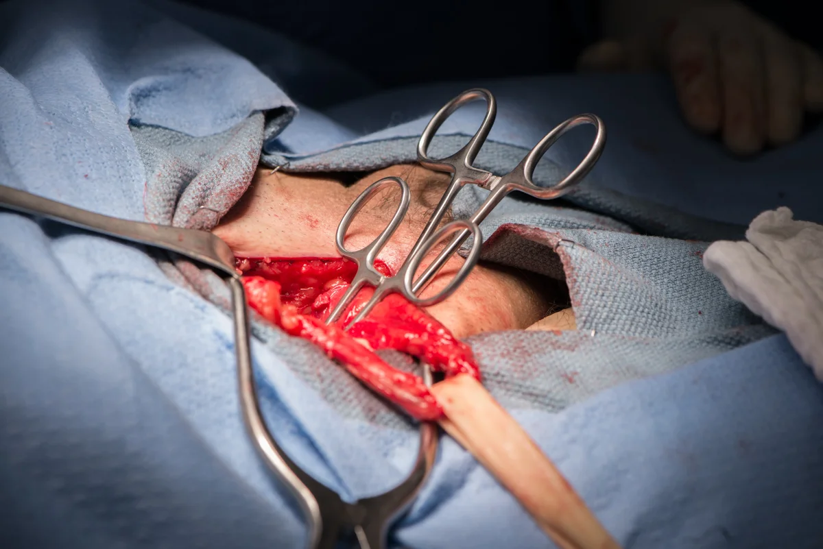 LZ_Surgical_06.jpg