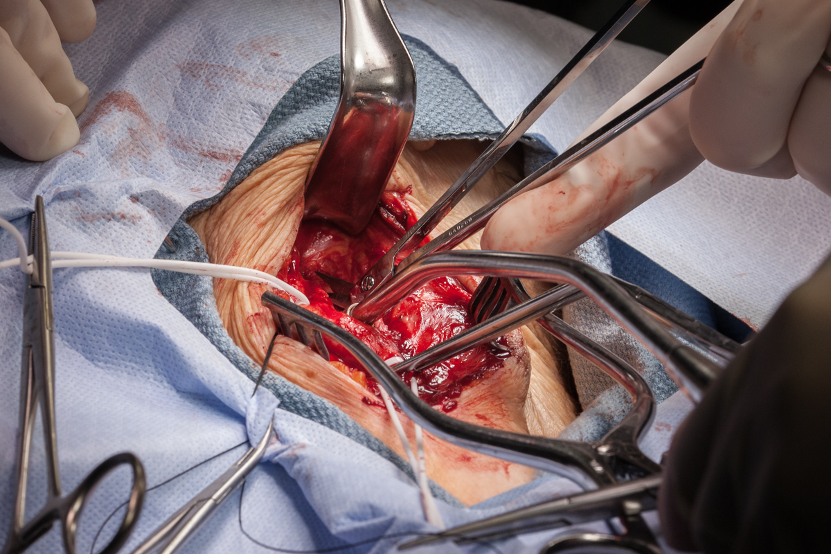 LZ_Surgical_09.jpg