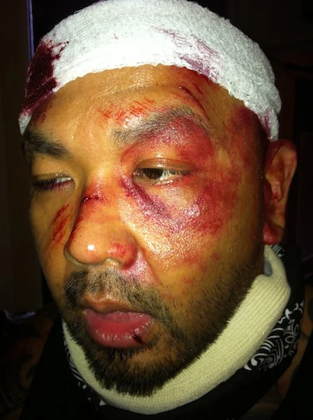 Injury 3.jpg