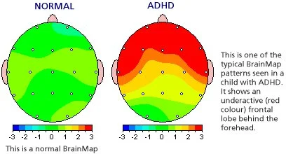 Dopamine is your friend. Me on the other hand, I have a pretty uneasy relationship with it.
