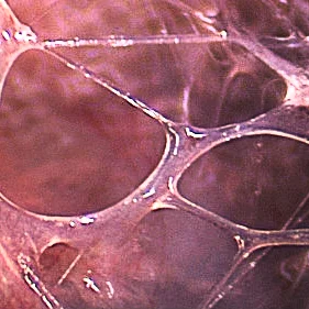 Yin Yoga & Faszien, Stress, Therapie