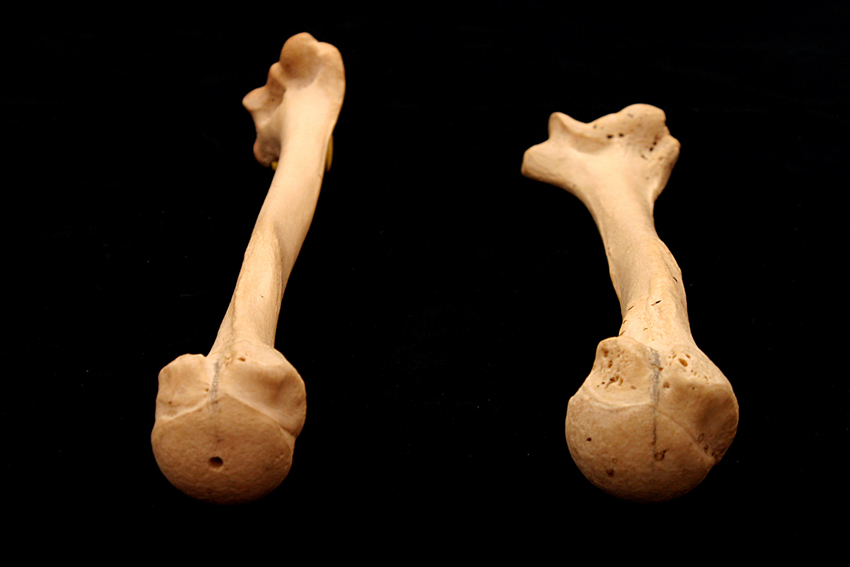 Humerus_Torsion_2 web.jpg