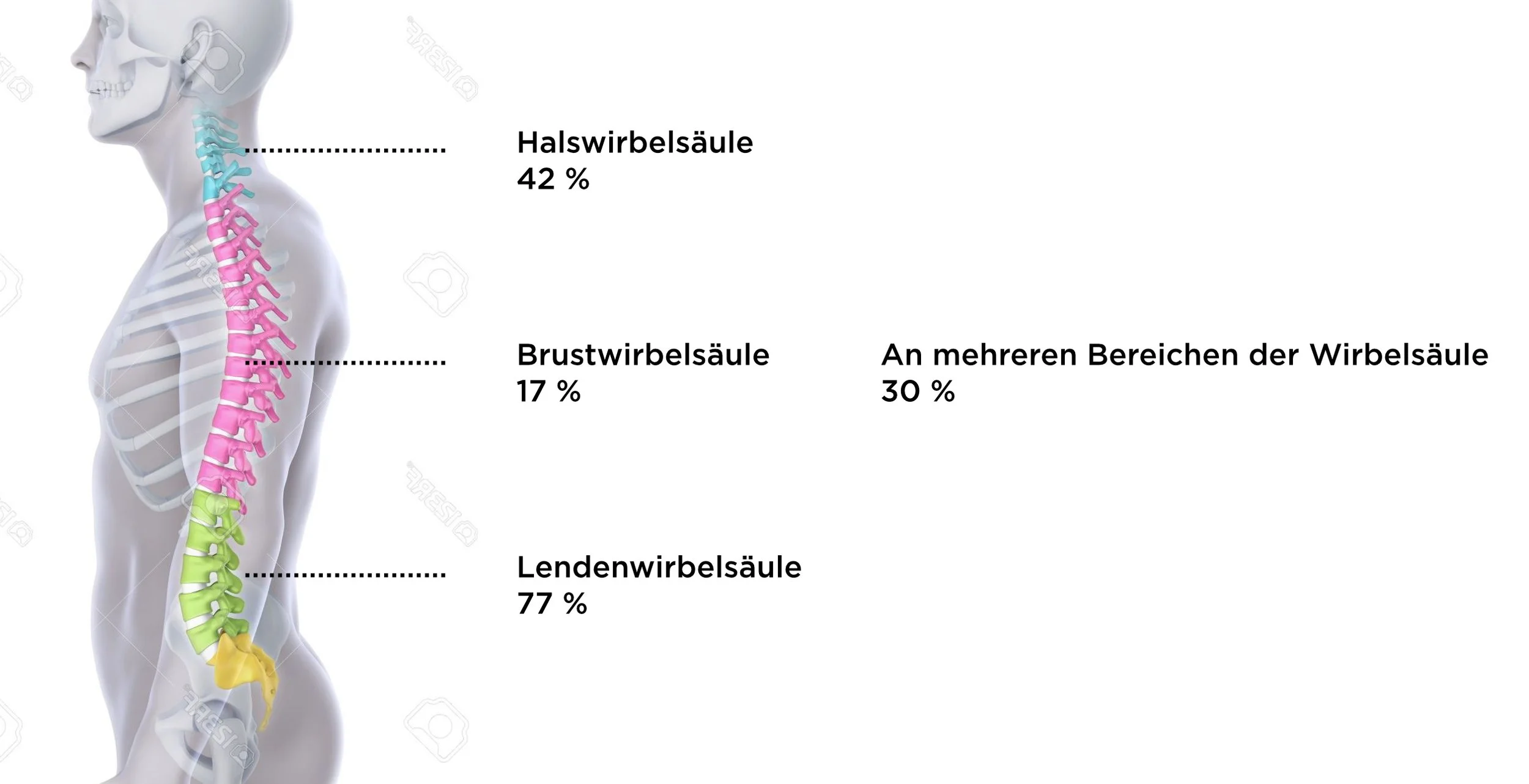 YIN THERAPYYoga Anatomie: Die Anatomie des Rückenschmerzes (DE ...