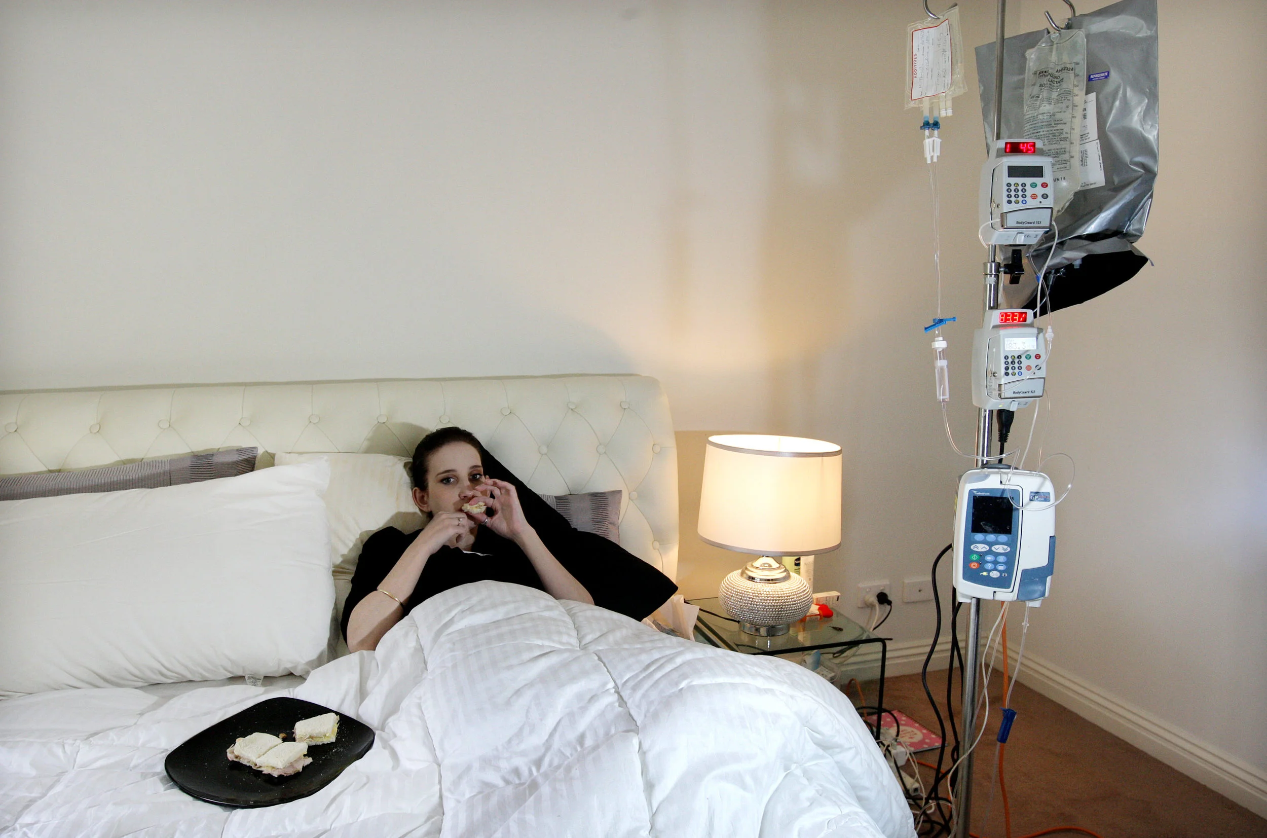 STOMACH TRANSPLANT-FF952813-582889.JPG