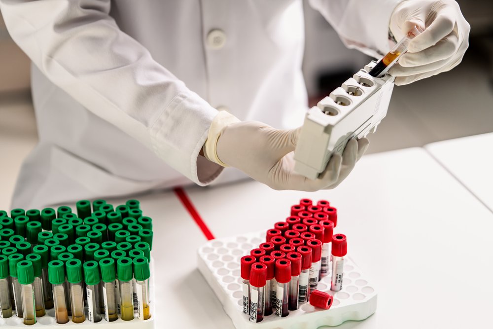 Close up as lab technician sorts blood tube samples in the laboratory.