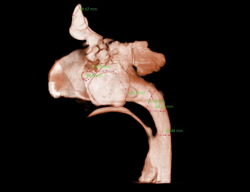 Sinus Evaluation