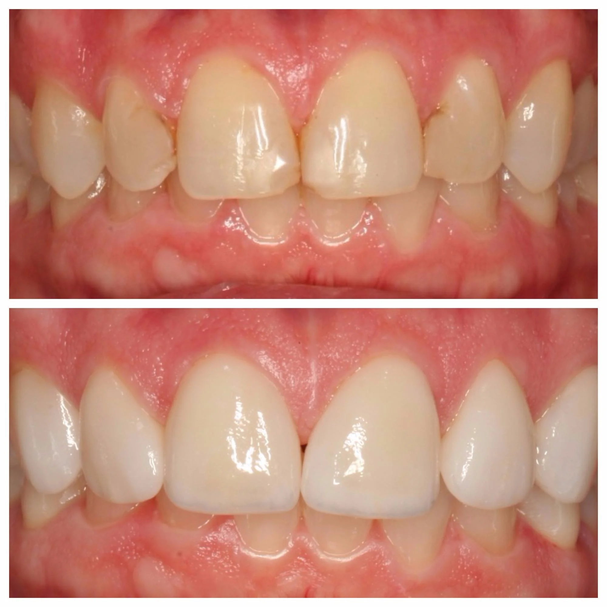 Before & After