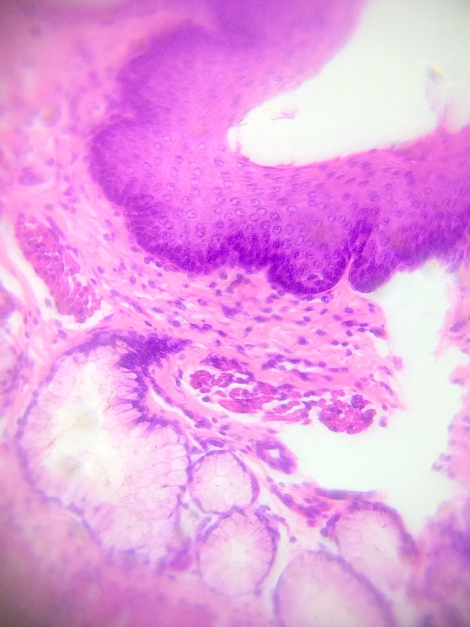 Esophagus tissue at ~377x (170x optical with 2.22x digital)