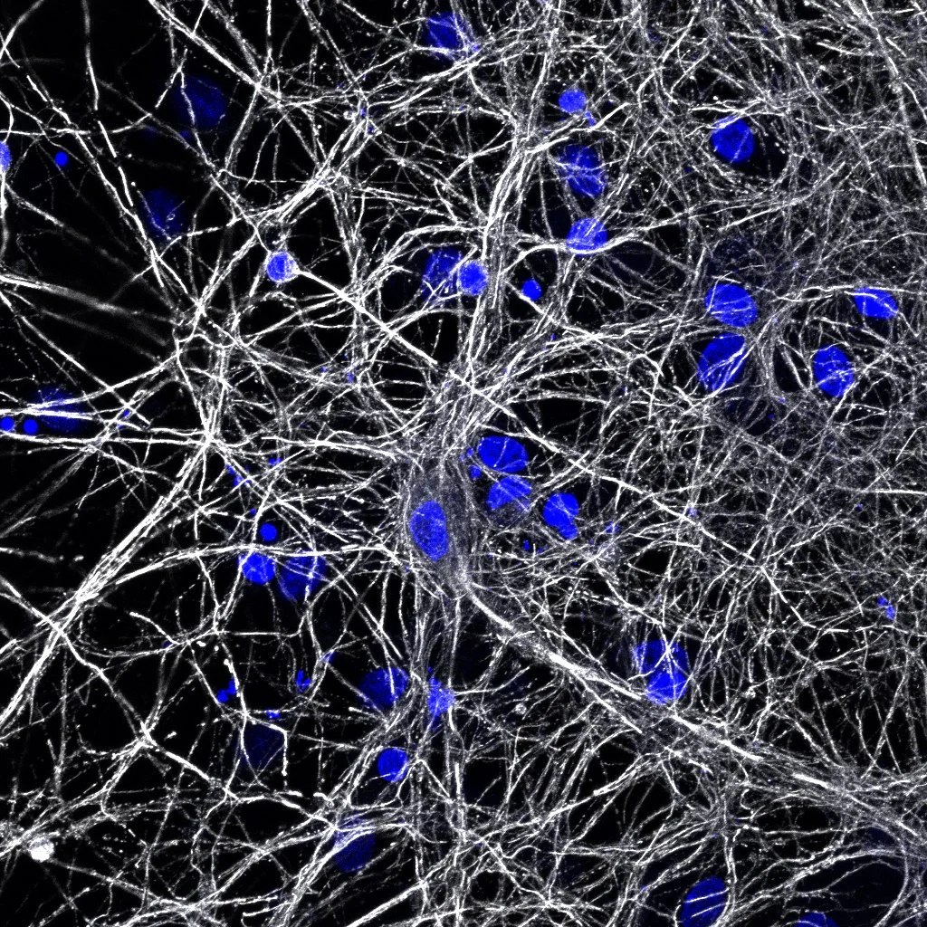 blue and grey neurons.jpeg