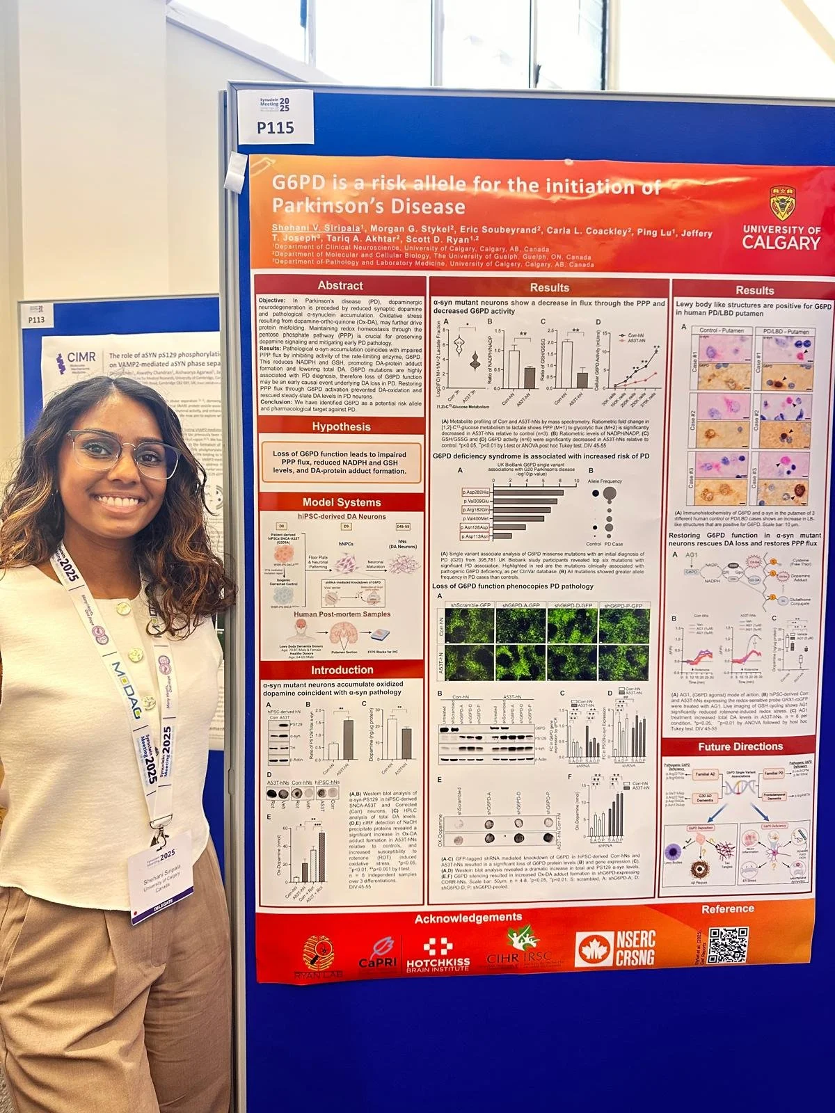 Shehani's Poster: G6PD is a risk allele for the initiation of PD