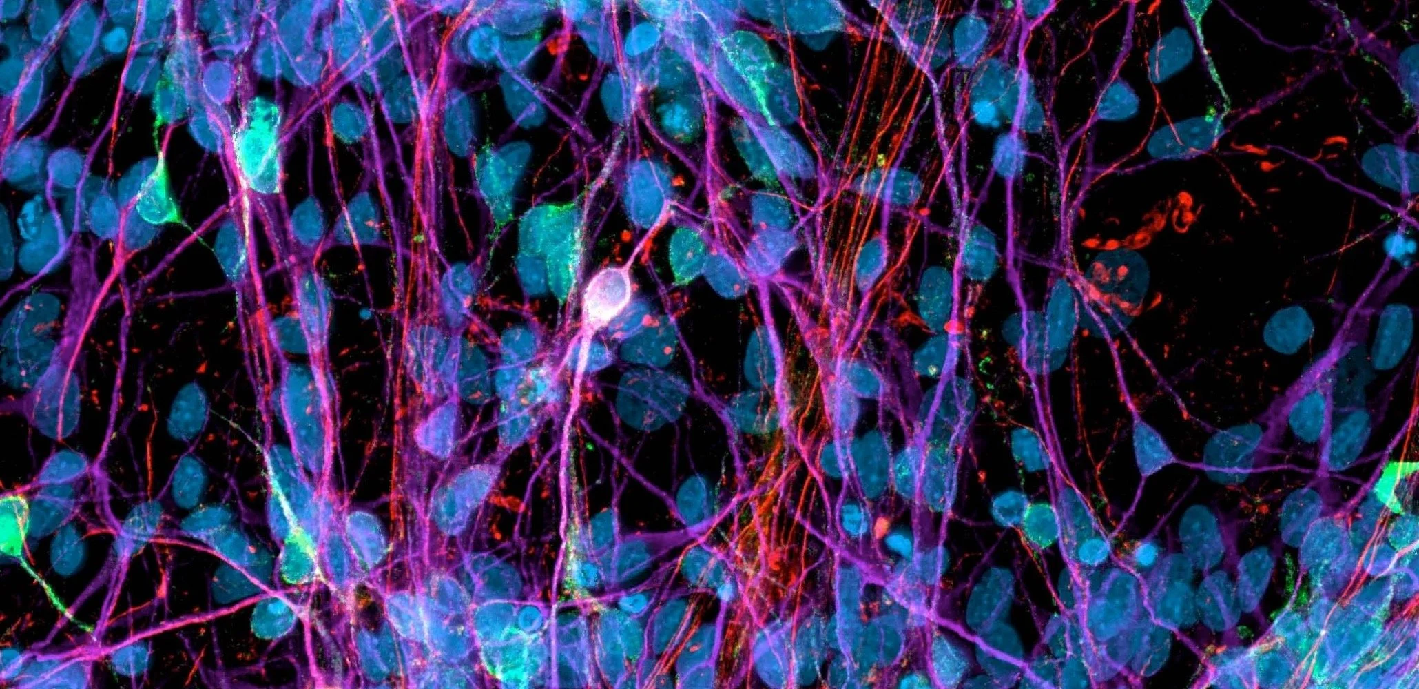 Fluorescence microscopy image of a network of hiPSC-derived neurons