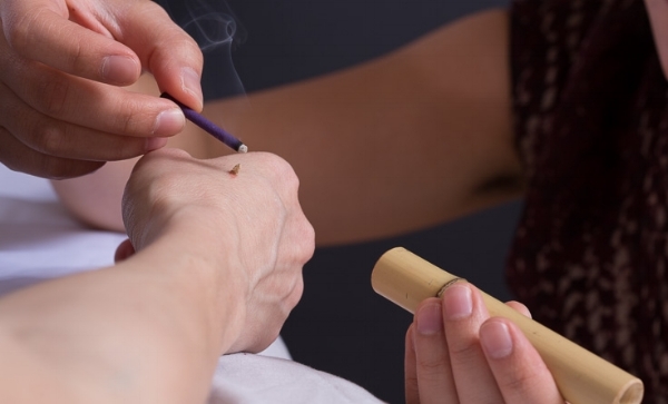 Moxibustion