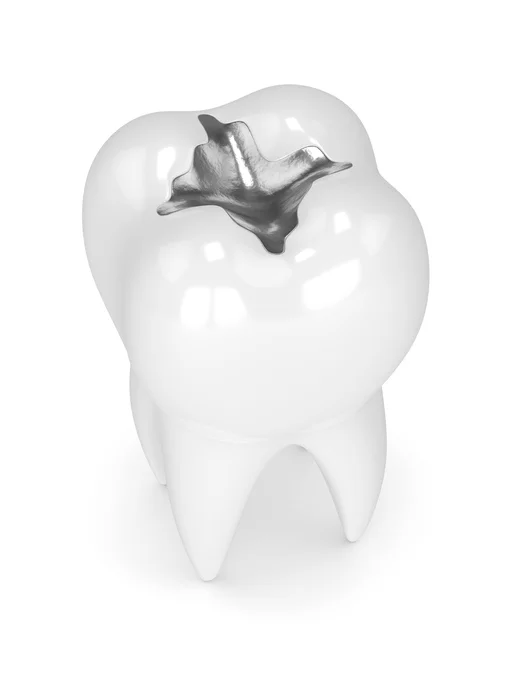 Amalgam.jpg
