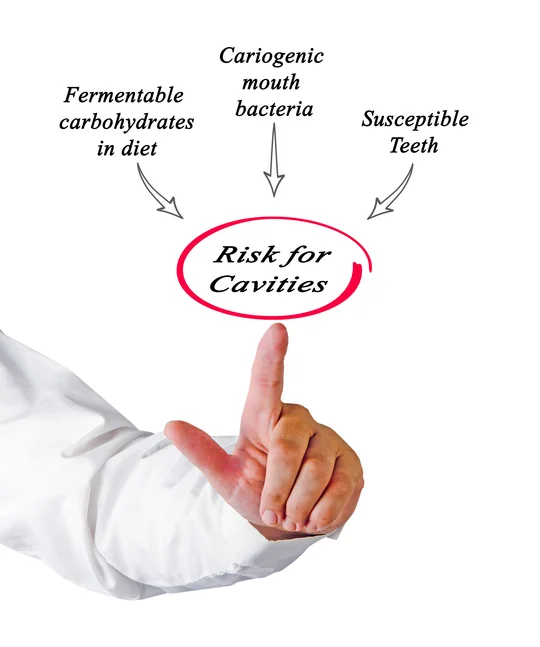 cavitychart.jpg