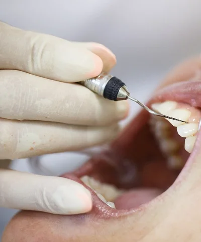 periodontal probe