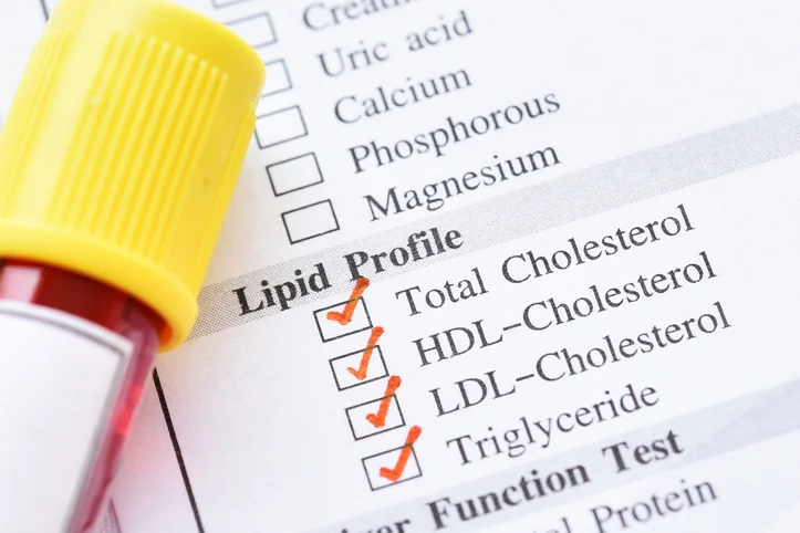 Cholesterol test tube.jpg