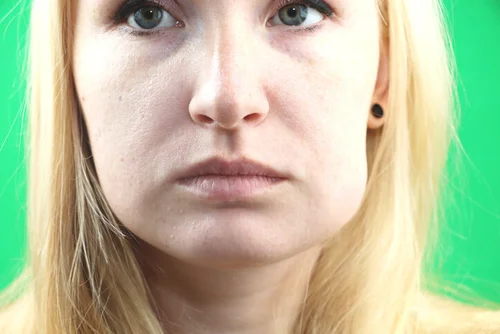 Blocked Salivary Glands: Home and Clinical Remedies — Dr. Scott Solomons Blocked Salivary Glands: Home and Clinical Remedies — Dr. Scott Solomons