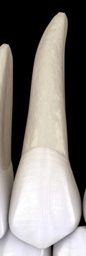 Dentition%2BLeft%2BSide%2BWith%2BRoots.jpg