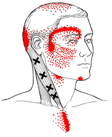 scm-trigger-points-1269542140.png