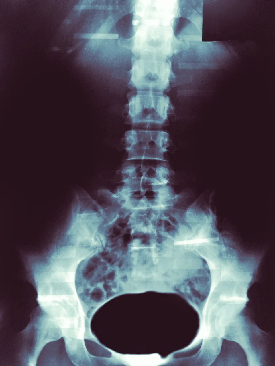 Is imaging necessary? - The answer may surprise you.