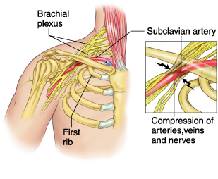 Image courtesy of http://www.mdguidelines.com/images/Illustrations/to_o_syn.jpg
