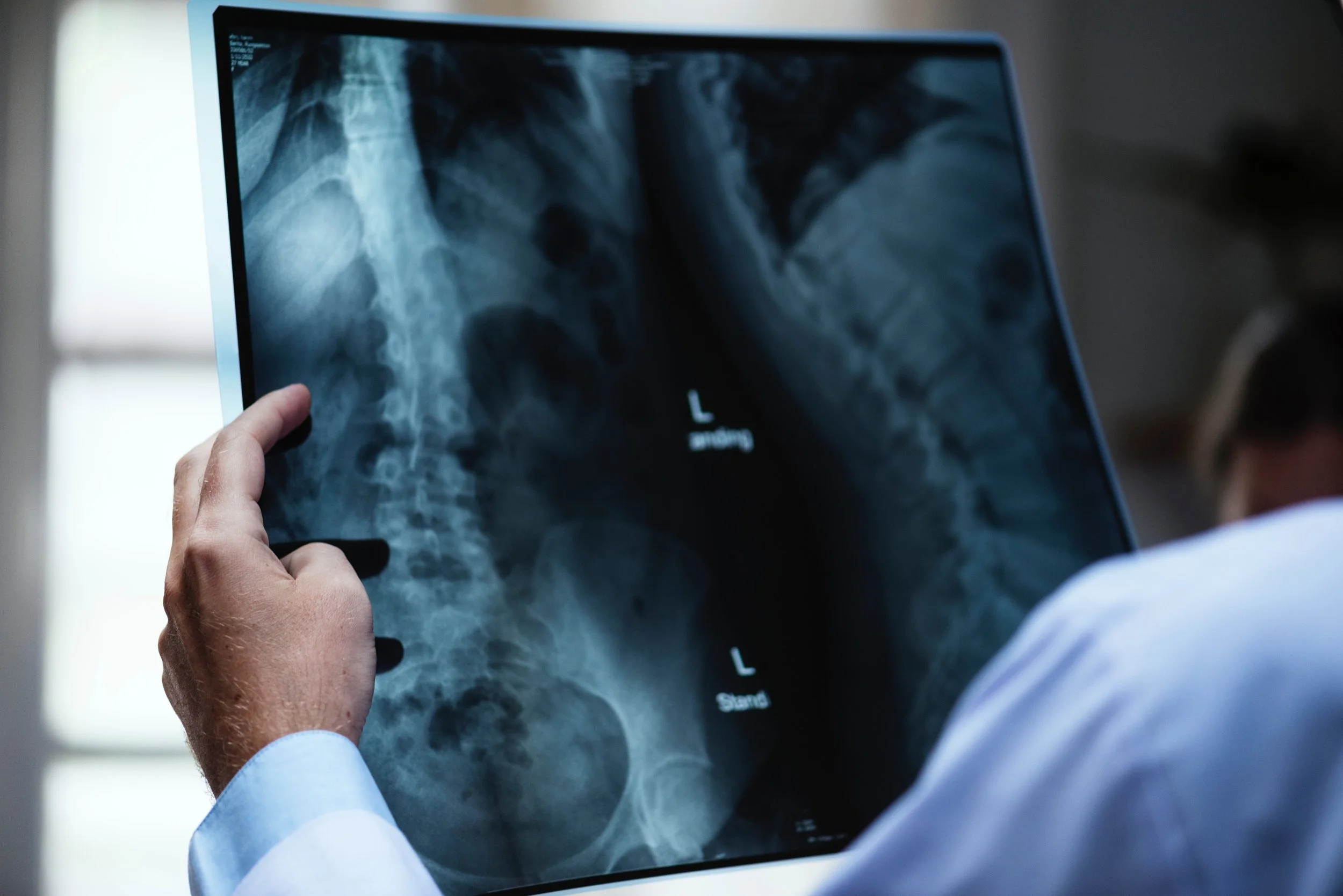 One Great Type of Exercise for Osteoporosis 