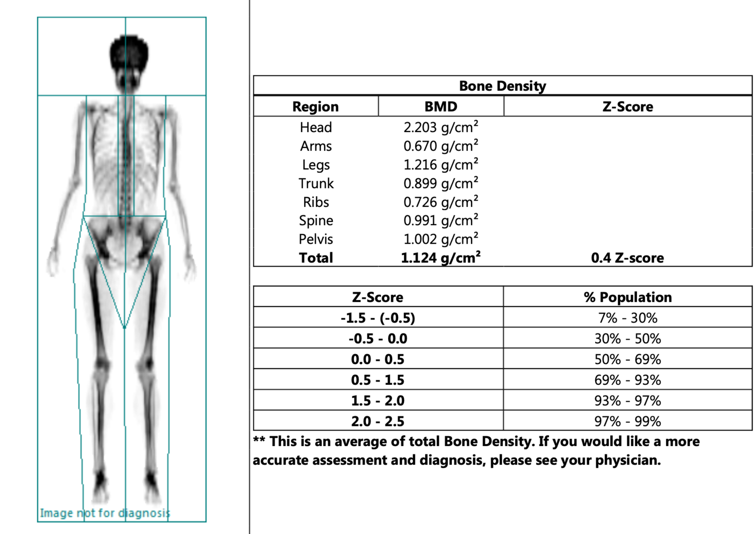 My experience with a DEXA Scan! What is it, and is it worth — Whole Body Health Physical Therapy Portland. Oregon