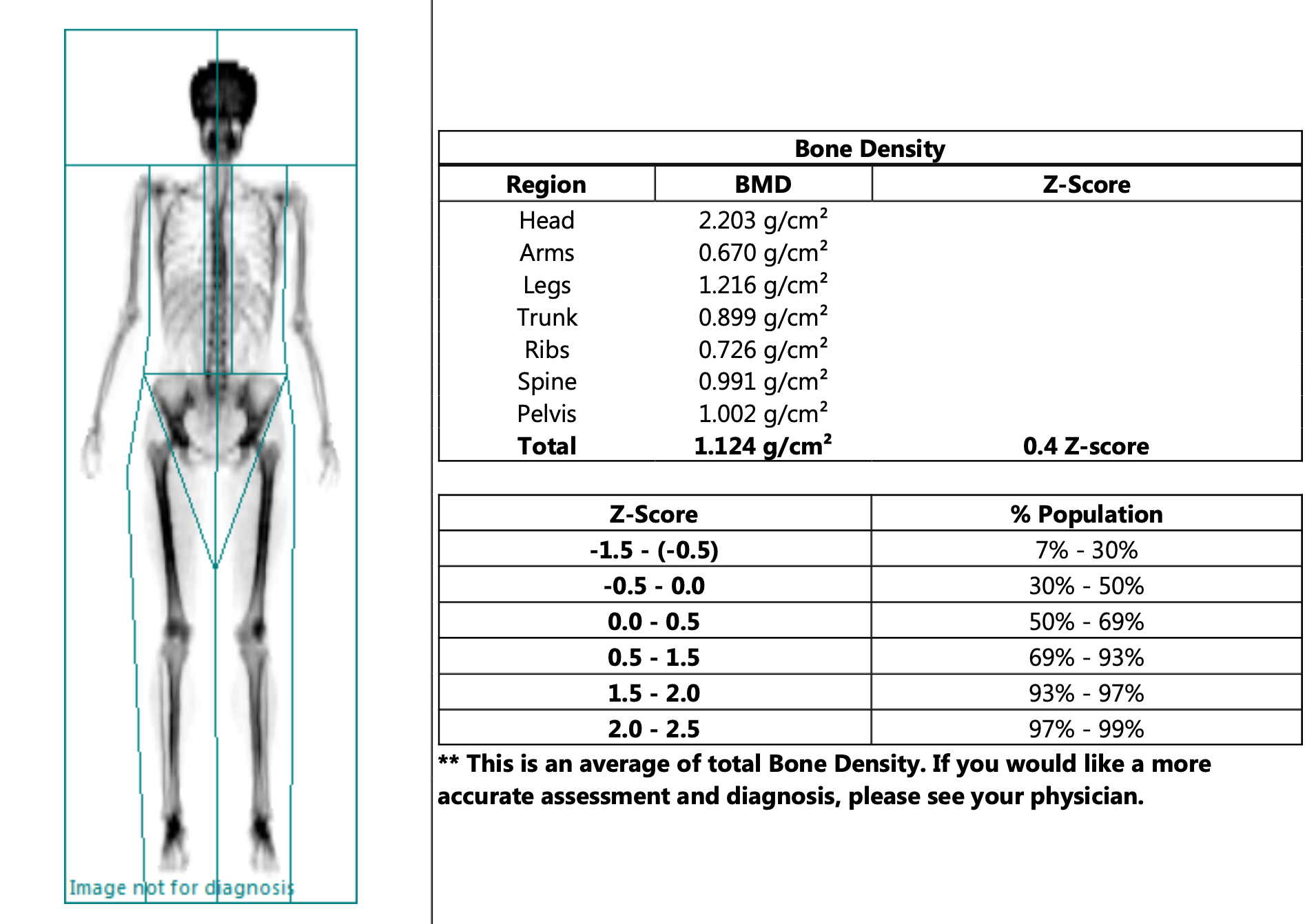 My experience with a DEXA Scan! What is it, and is it worth it? Whole Body Health Physical Therapy Portland. Oregon