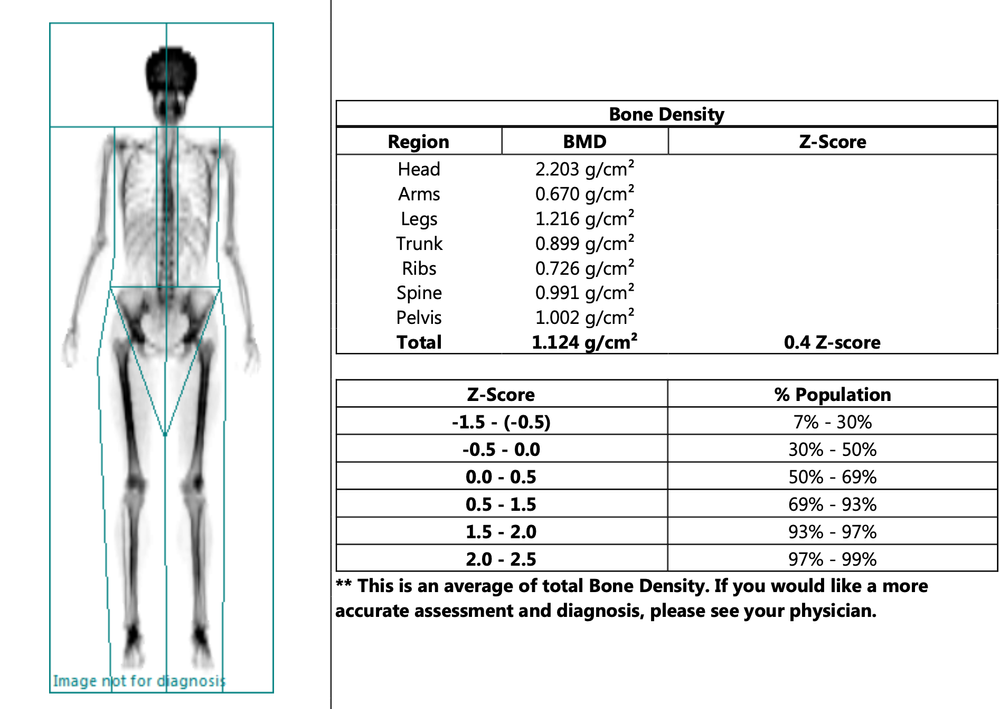 My experience with a DEXA Scan! What is it, and is it worth it? — Whole