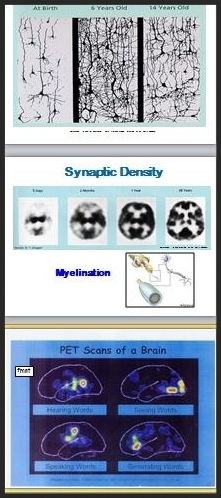 brainslides.jpg