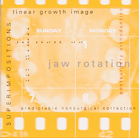 thumbnail brochures.png