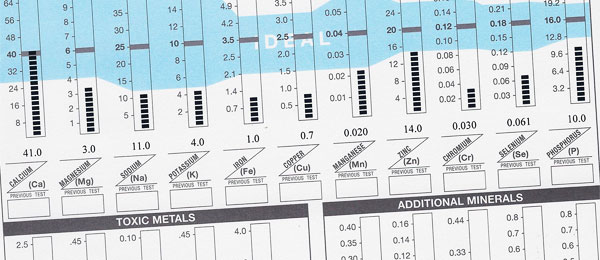 image: hairmineralanalysis.co.uk