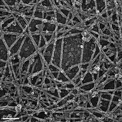 actin networks.jpg