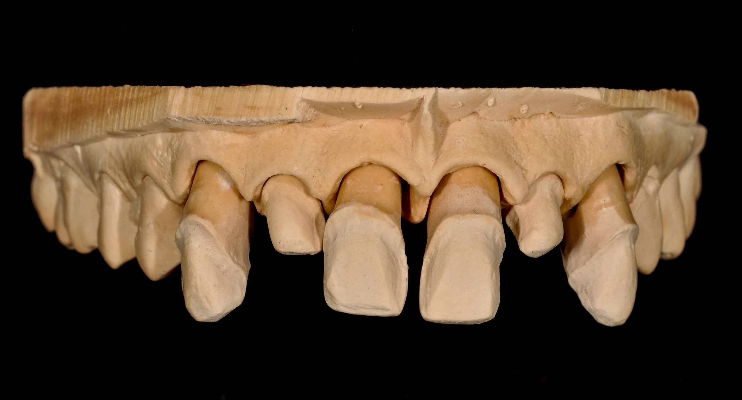 Removable Prosthodontics, Implants, Same Day Model Free Crowns, Full