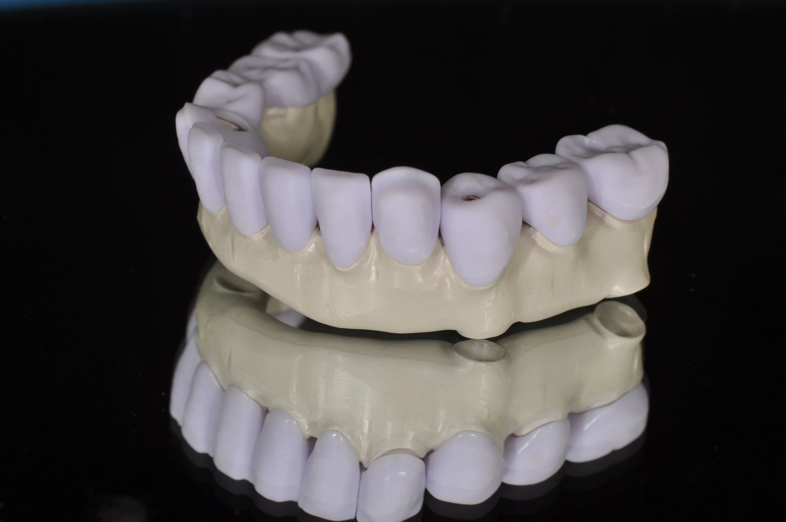 Removable Prosthodontics, Implants, Same Day Model Free Crowns, Full