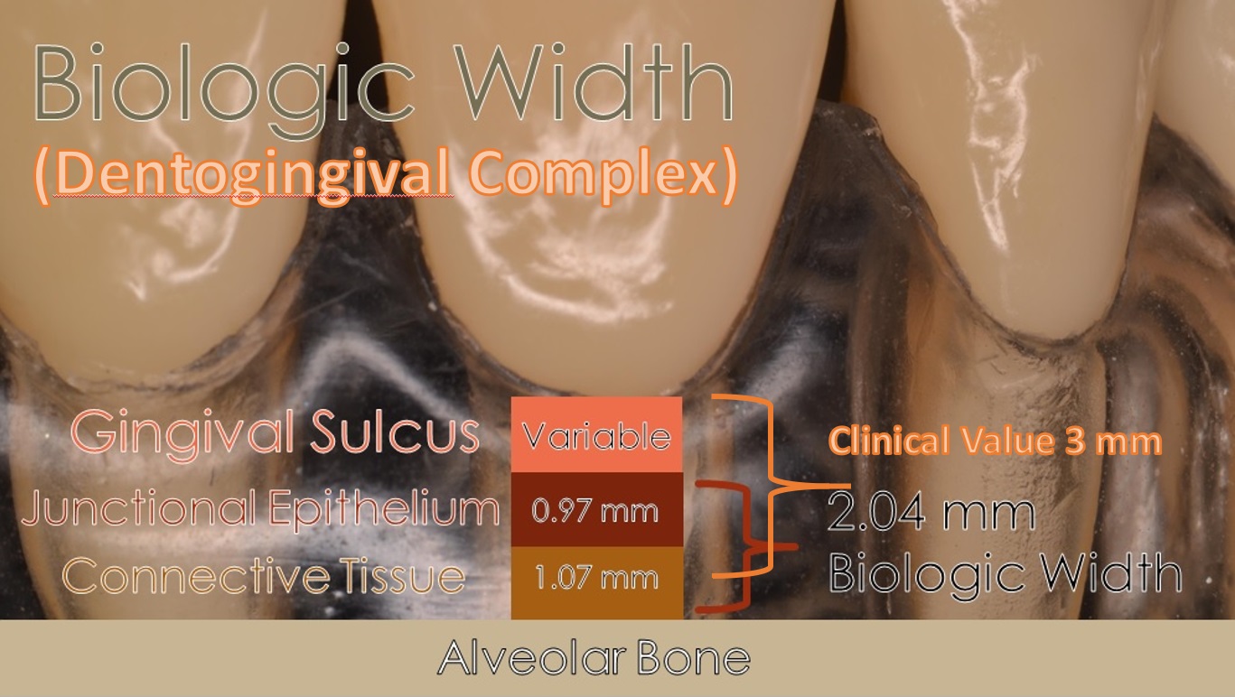 Figure 4; Representation of the dentogingival complex (biologic width).