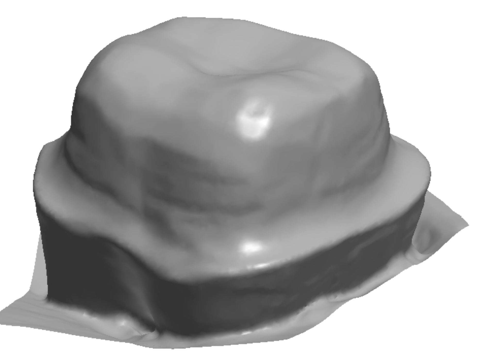 eMax Preparation Guidelines for Posterior Teeth