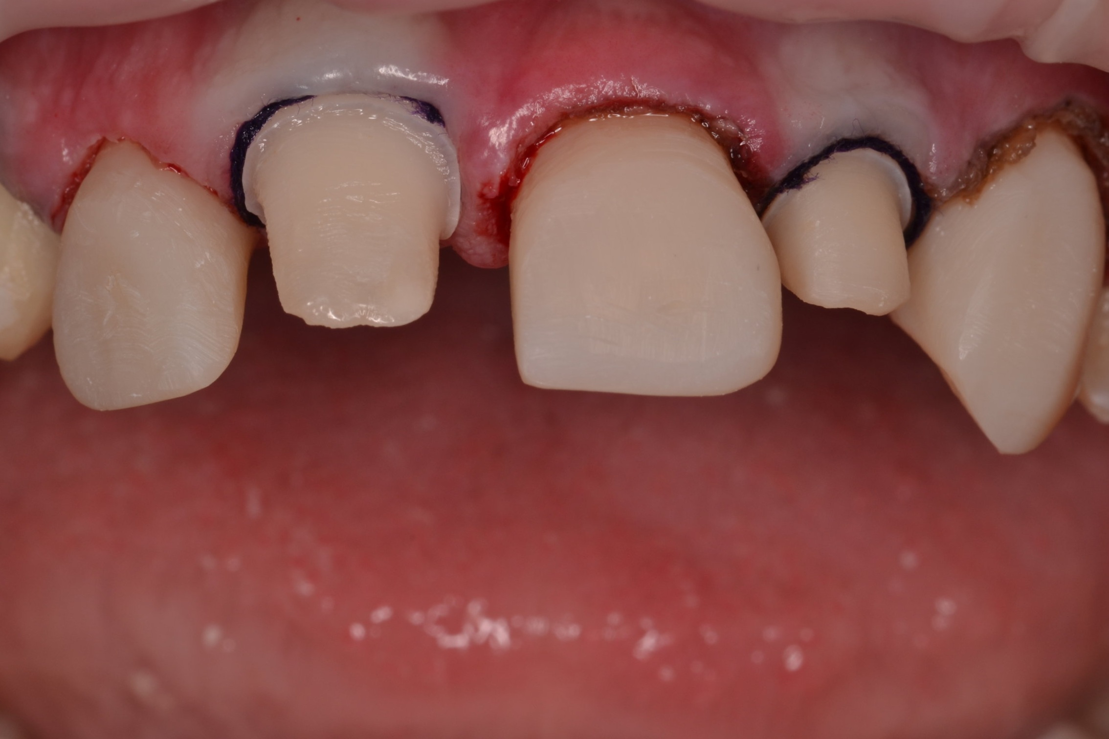 Figure 10a ;