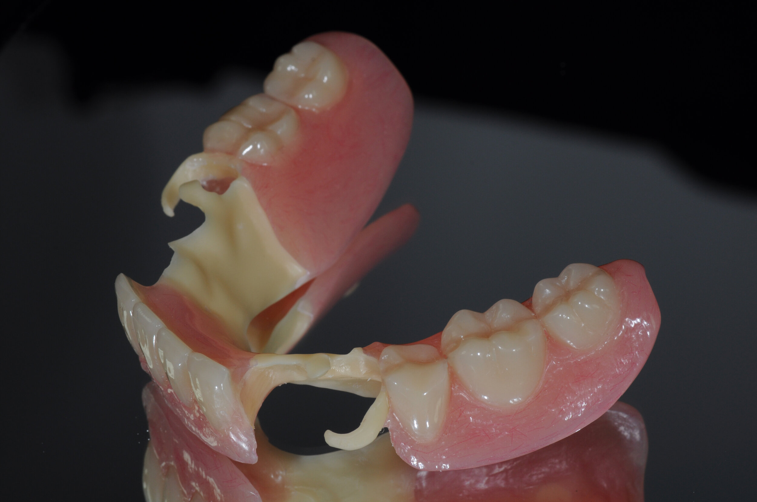 Removable Prosthodontics