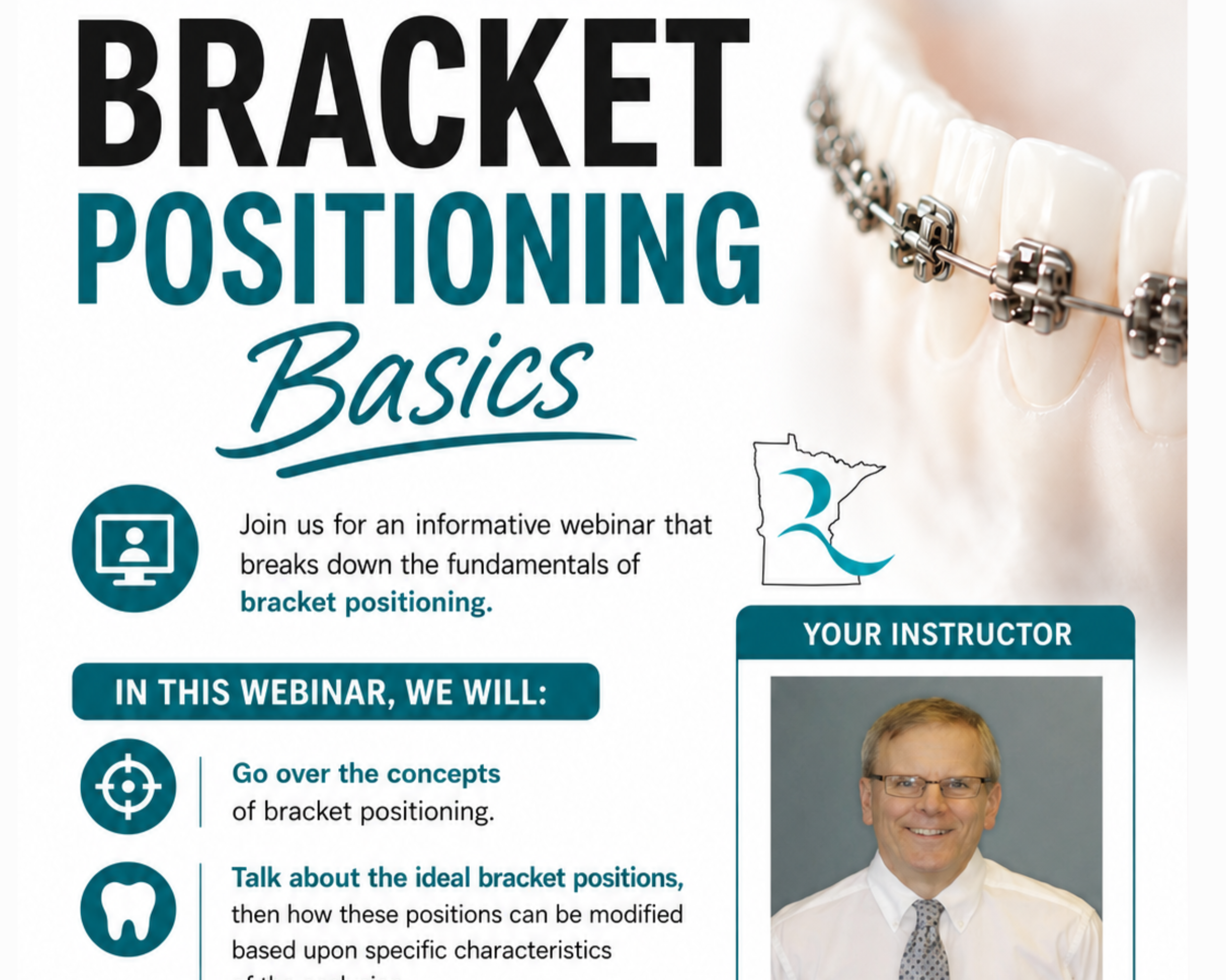 Bracket Positioning Basics 