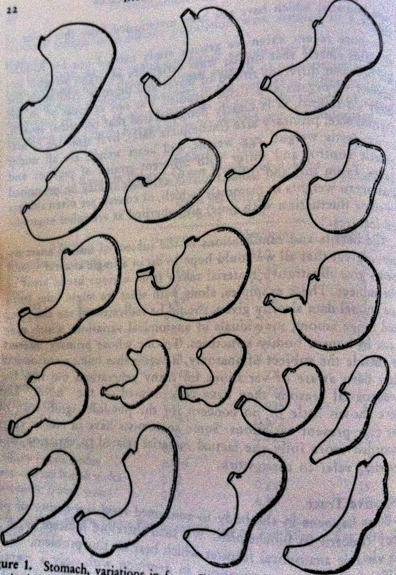The many variations of the stomach