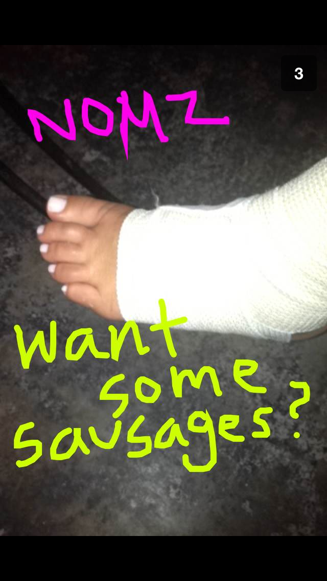 The joys and wonders of snapchat. Swelling is no fun.
