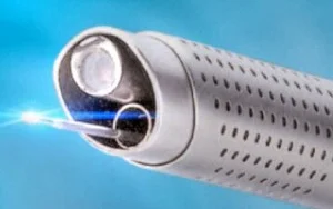 Holmium laser now available for transurethral resection of the prostate surgery