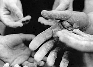 The photographer writes, "These are the hands of all random climbers. To me this picture sums up the end of the day. Where your tips are blown, flappers torn, and chalk seems to be permantly stuck on your hand. All of these things are what makes a climber know that he/she has had a sweet day of climbing."