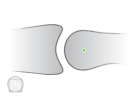 How about in a human body joint? Most of the human joints are angular motion(rotary motion) joints since almost all joint have axis.