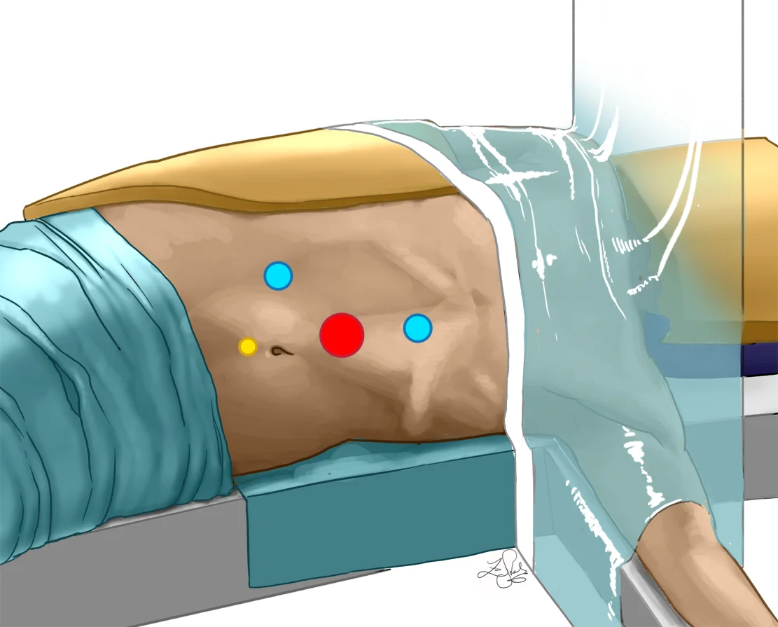 intraopfigure1.jpg