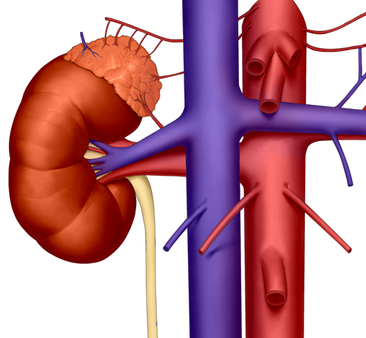 kidney1_2_crop.png